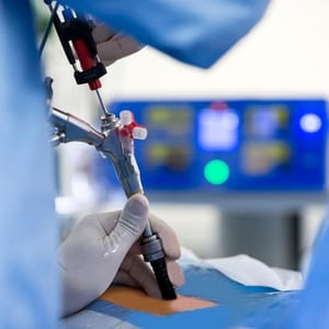 Endoscopy for Spine & Pain Management