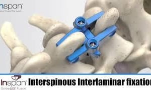 KIC Inspan