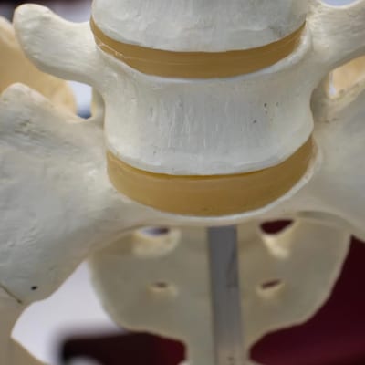 Sacroiliac Joint Dysfunction